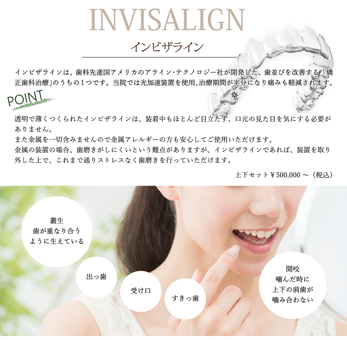 インビザライン