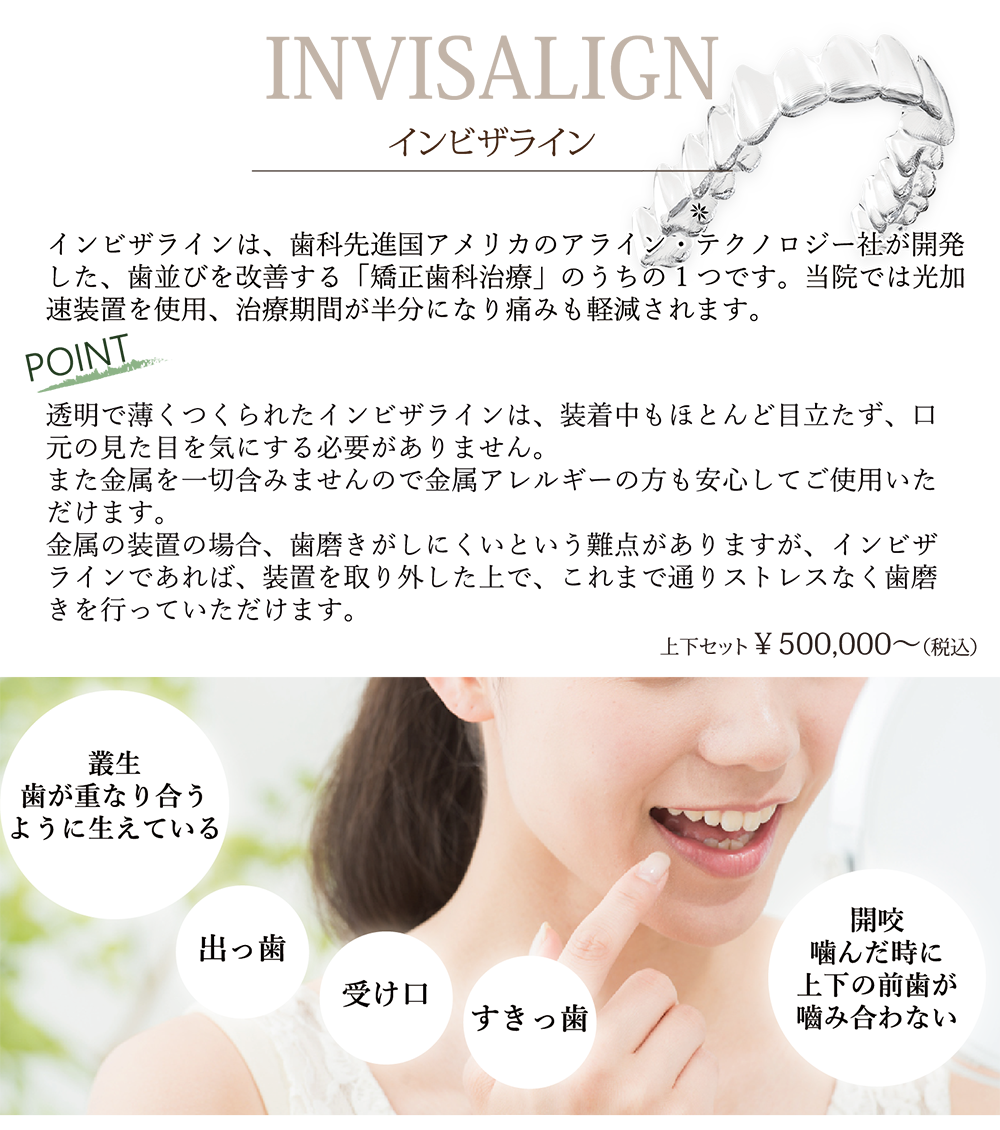 インビザライン