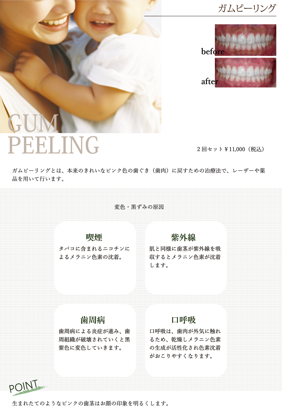 ガムピーリング